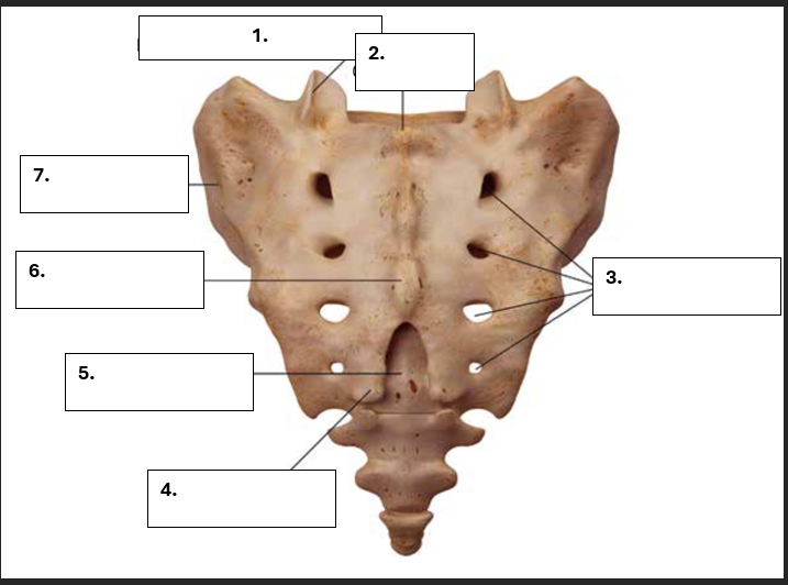 <p>Benoem de volgende onderdelen van os sacrum.</p>