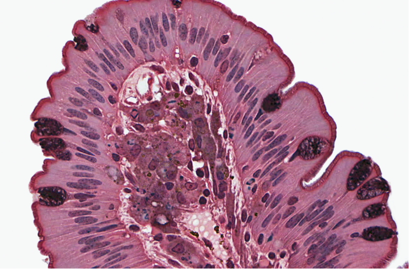 <p>Classify the epithelium. What is the function of this epithelium?</p>