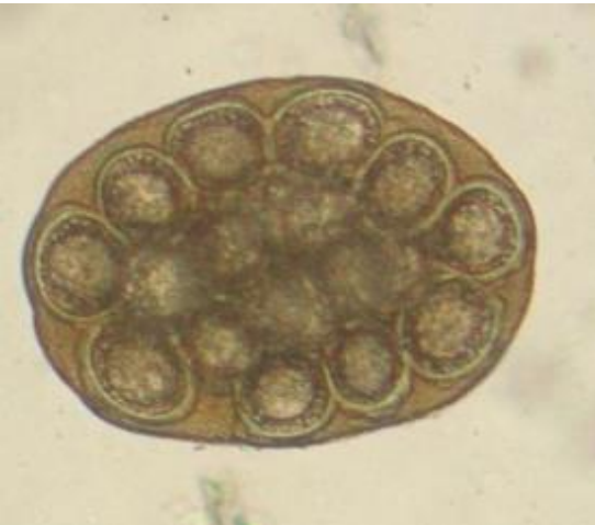 <p>Coprological exam: <em>name the parasitic egg and describe</em></p>