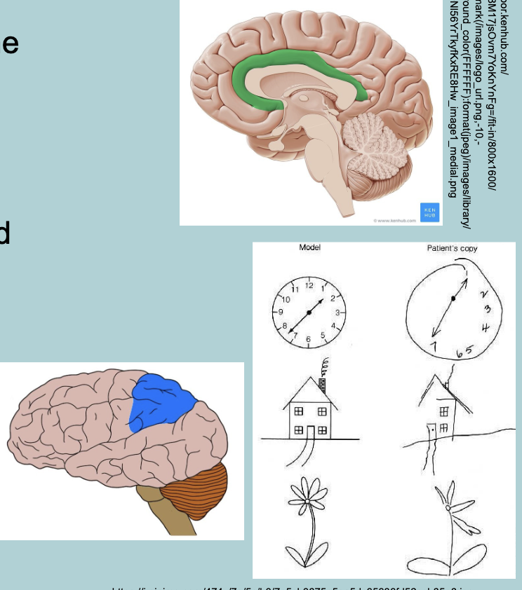 <p>Posterior parietal cortex:</p><ul><li><p>POLY MODAL cells&nbsp;</p></li><li><p>Damage = NEGLECT&nbsp;</p></li><li><p>Neglect affects usually one side of the body = CONTRALATERAL&nbsp; NEGLECT (left site of brain affect → affects right side of body)</p></li></ul><p></p>