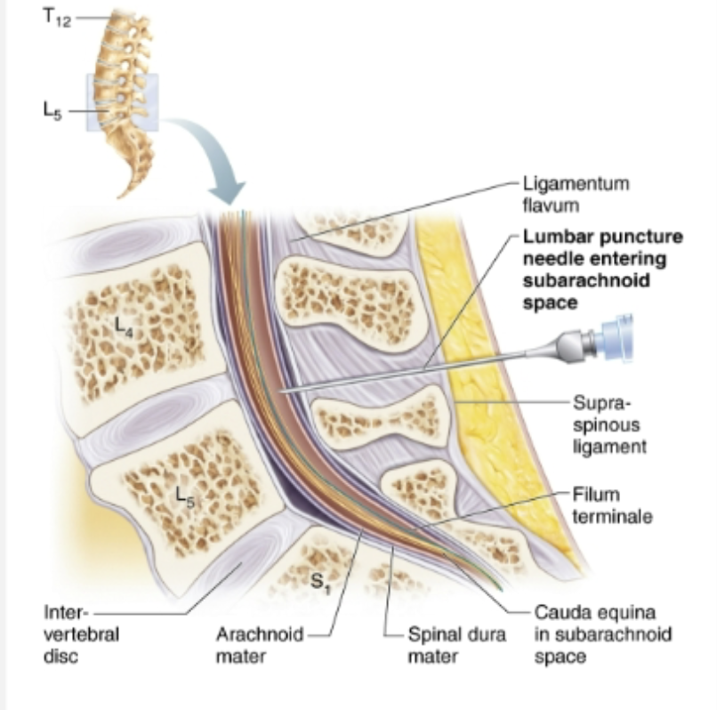 <p><code>Gross Anatomy  of the Spinal Cord</code></p><ul><li><p><strong>STRUCTURE </strong></p><ul><li><p>CSF fills subarachnoid space between arachnoid and pia maters </p></li><li><p>Dural and arachnoid membranes extend to sacrum, beyond end of cord at L1 or L2 </p><p>→ Site of lumbar puncture or tap  </p></li></ul></li><li><p><strong>FUNCTION </strong></p><ul><li><p>Cushion of fat and network of veins in space between vertebrae and spinal dura matter</p></li></ul></li></ul><p></p>