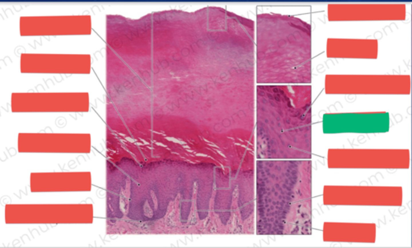 knowt flashcard image