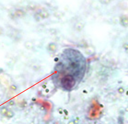 <ul><li><p style="text-align: justify;"><span style="background-color: transparent;"><span>Identify the organism. Give genus and species.</span></span></p><ul><li><p style="text-align: justify;">(1)</p></li></ul></li><li><p style="text-align: justify;"><span style="background-color: transparent;"><span>What is the morphologic stage of the organism?</span></span></p><ul><li><p style="text-align: justify;">(2)</p></li></ul></li><li><p style="text-align: justify;"><span style="background-color: transparent;"><span>Identify the structure pointed by the red arrow.</span></span></p><ul><li><p style="text-align: justify;">(3)</p></li></ul></li></ul><p></p>