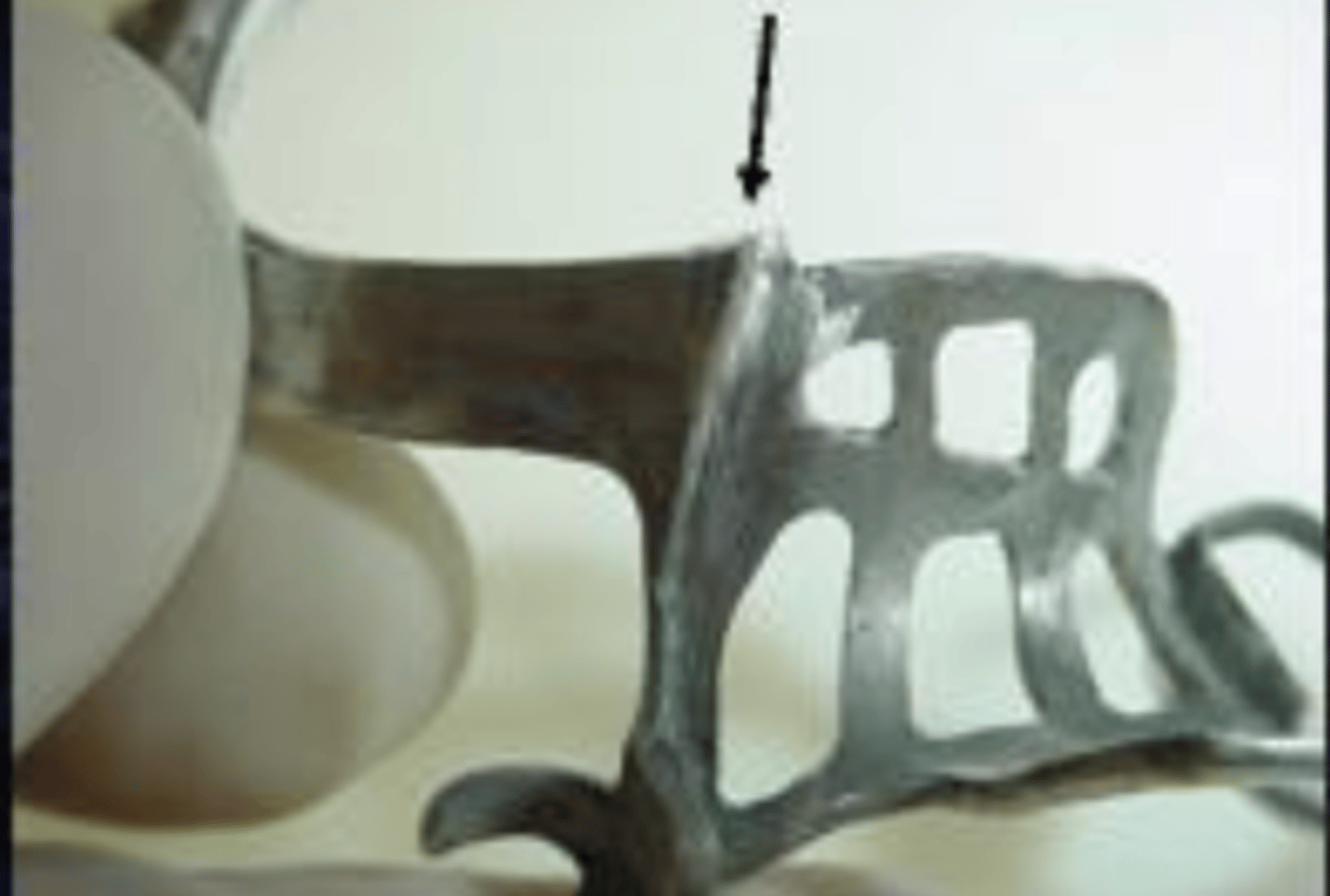 <p>What is the arrow pointing to?</p>