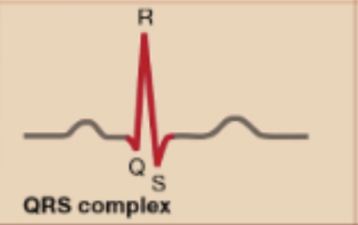<p>QRS Complex </p>