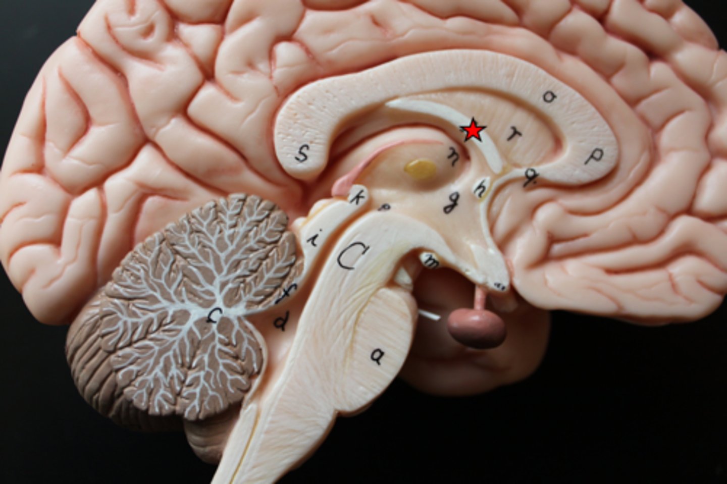 <p>arched fiber tract connecting hippocampus to mammillary bodies</p>