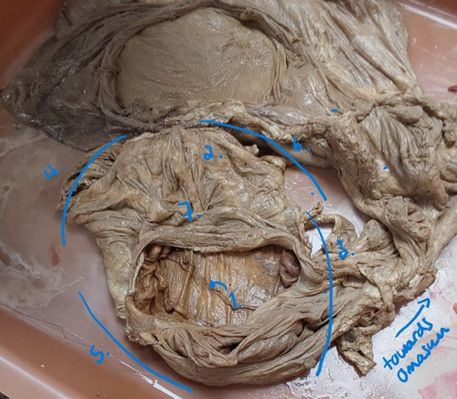 <p>2nd flashcard of abomasum structures (same)</p>