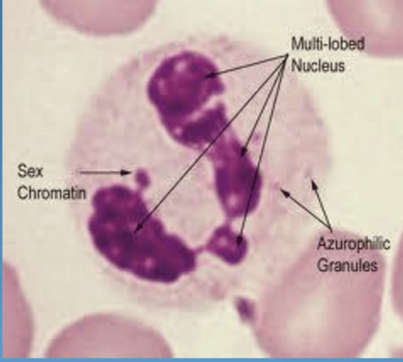 <p>- feature of healthy gingiva</p><p>- forms barrier between subgingival plaque and gingival tissues</p><p>- phagocytes</p><p>-secrete enzymes = degradation of junctional epithelium BM</p><p>- migrate from gingival plexus to CT in response to chemotactic gradient (pathway to bacteria)</p>
