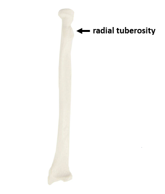 <p>What bone is this?</p>