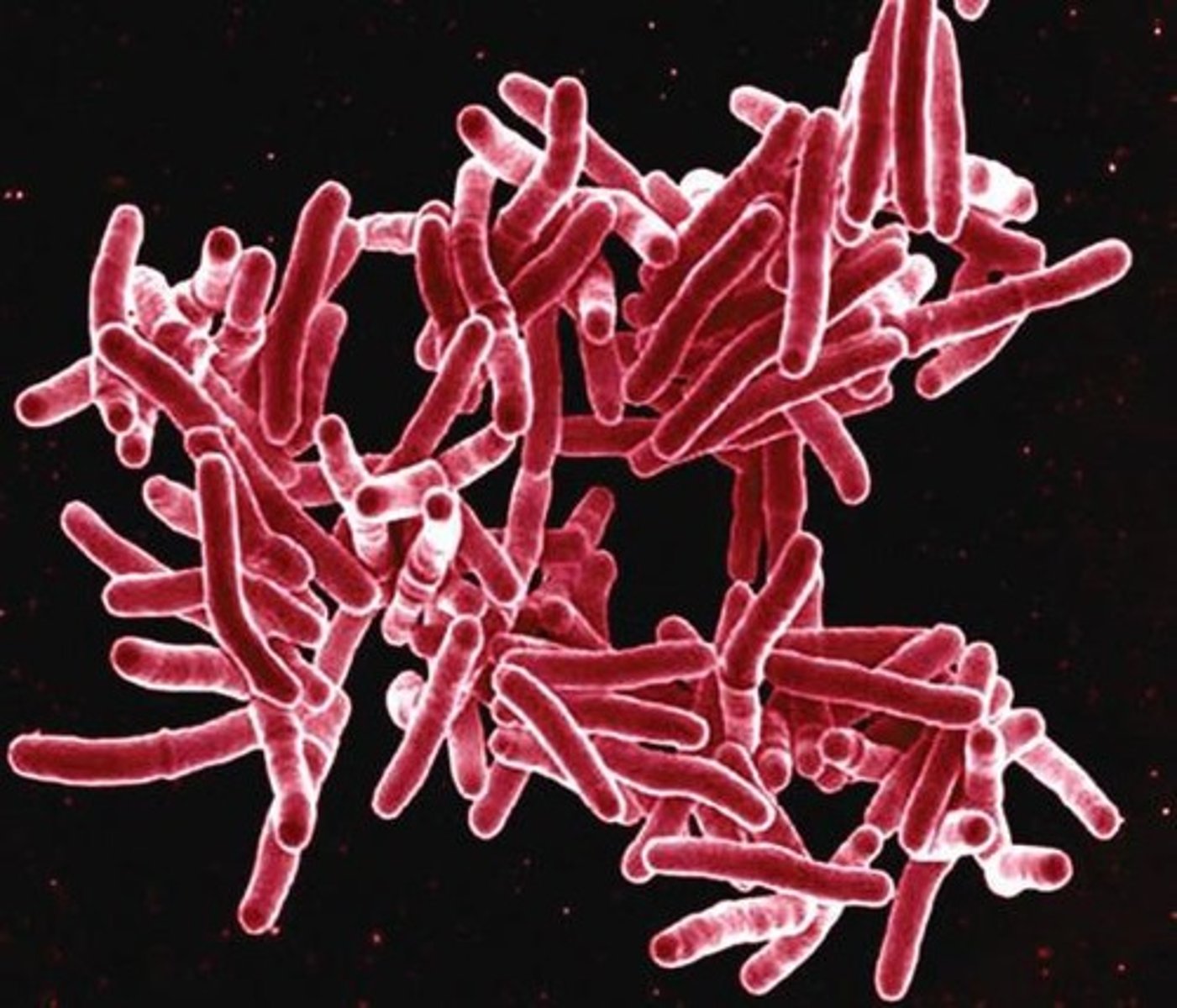 <p>Gram-positive, irregular bacilli that are acid-fast, strict aerobes, and grow slowly.</p>