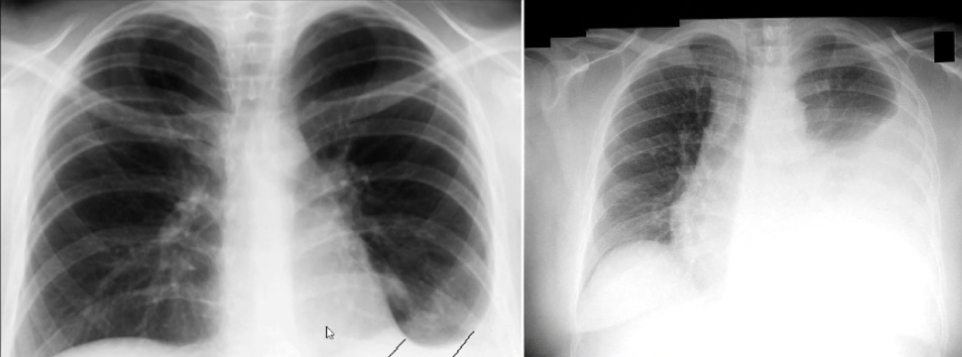 <p>diagnosis</p>
