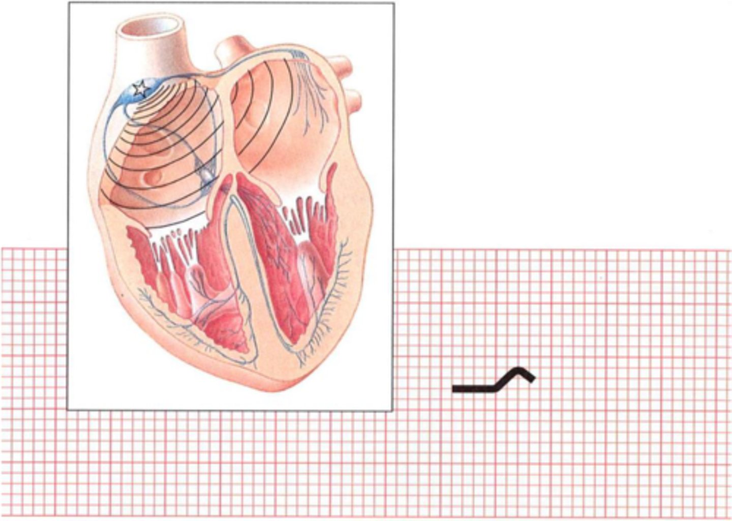 <p>Atrial contraction occurs</p>