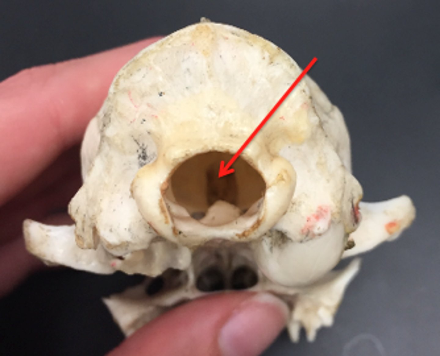 <p>large opening where the spinal cord exits the skull</p>