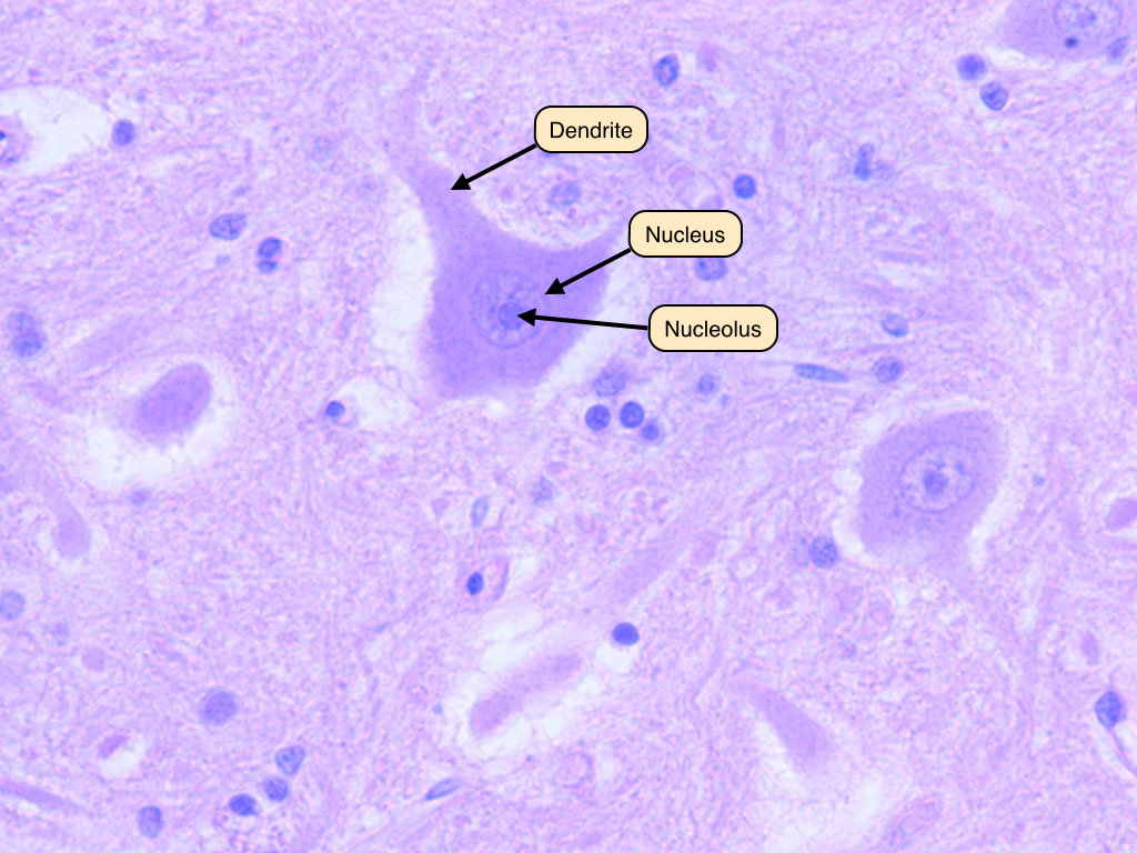 <p>The depicted microscopic slide shows a _______</p>