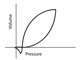 <p>A 24-year-old patient is receiving mechanical ventilation. The following pressure - volume graph is available. What can accurately be stated about this information?</p><p>inspiratory flow is set too high </p><p>sensitivity is set too high</p><p>this breathing was machine-initiated</p><p>this breathing was machine-initiated </p>
