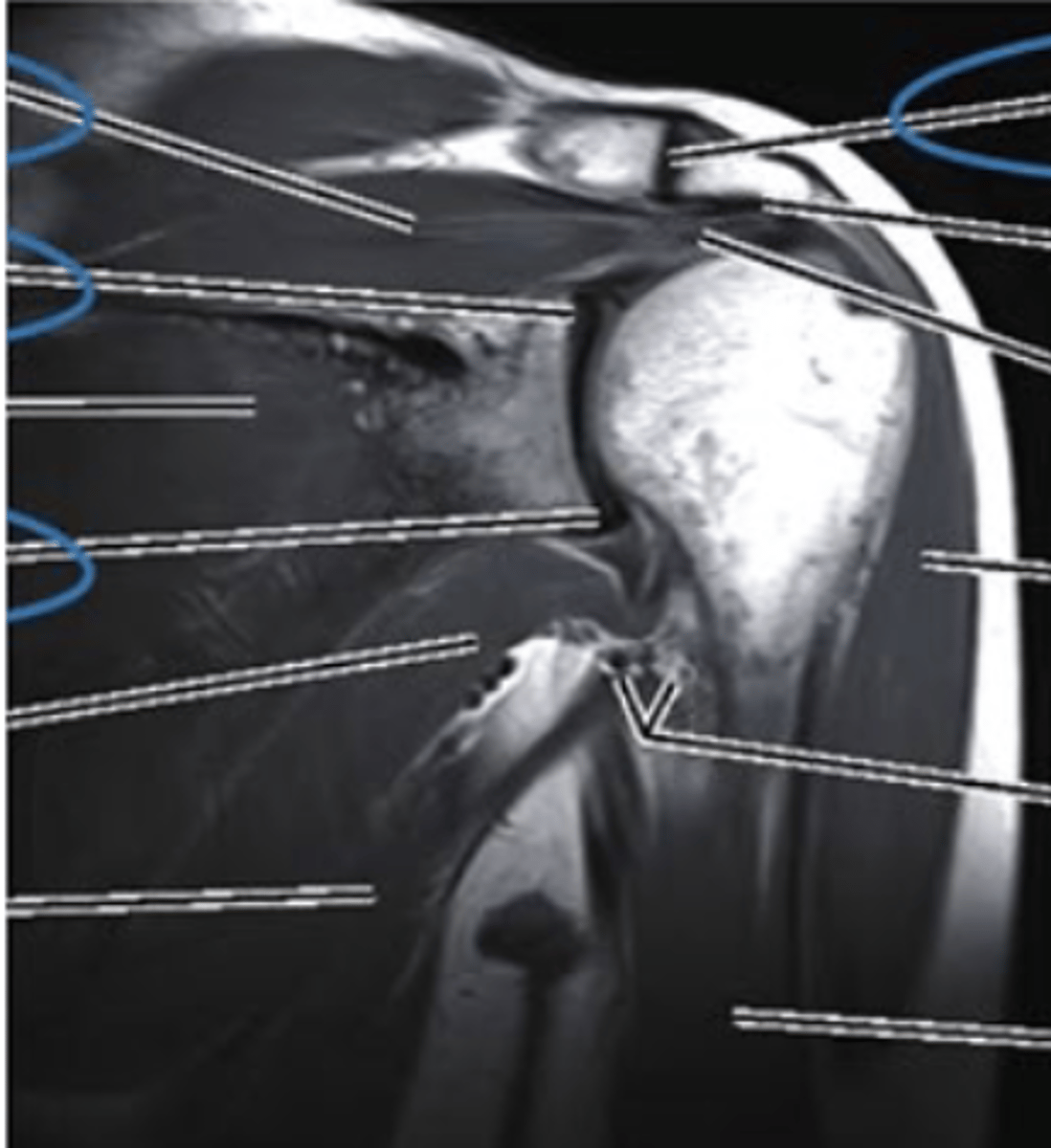 <p>what imaging type and view is this?</p>