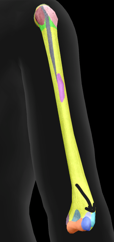 term image