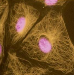 <p>what are the gold structures made of </p>