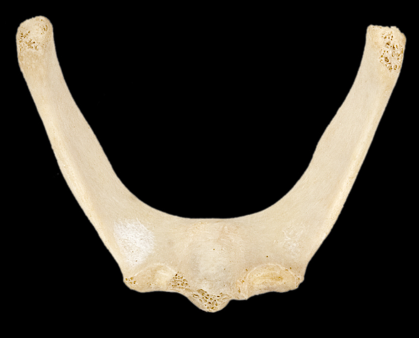 <p>Name this bone.</p>