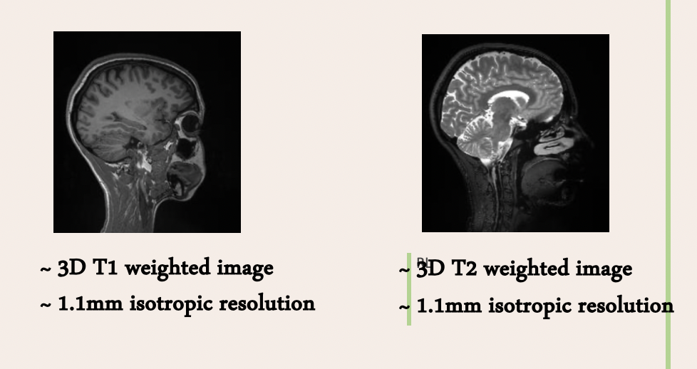 <p>T1 - better for anatomical detail and normal brain structure </p><p>T2 - better for tumours, inflammation, trauma as sensitive to water ( so tumour would appear as a light liquid)</p>