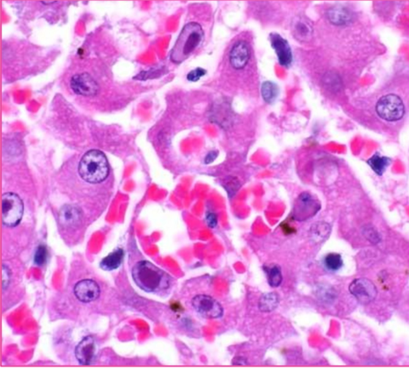 <p>which viral inclusion</p>