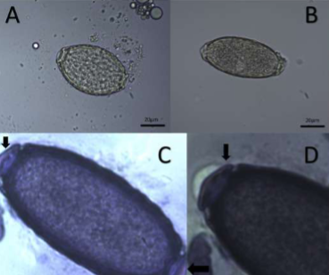 <p>what lifecycle does <span style="color: rgb(250, 243, 243);"><span>Pearsonema plica/ Pearsonema feliscati have</span></span></p>