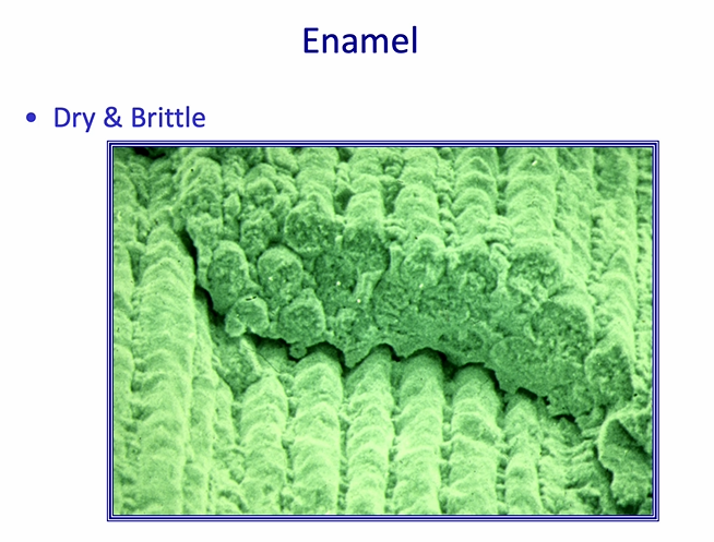 <ul><li><p><strong>dry and brittle&nbsp;</strong></p></li><li><p>very strong in <em>certain directions</em></p></li><li><p>can be<strong> dried out </strong>to remove most of the water in the structure at the surface where it has been cut&nbsp;</p></li><li><p>we usually try to <strong>increase </strong>the surface area - this is achieved by etching the surface of enamel&nbsp;</p></li></ul><p></p>