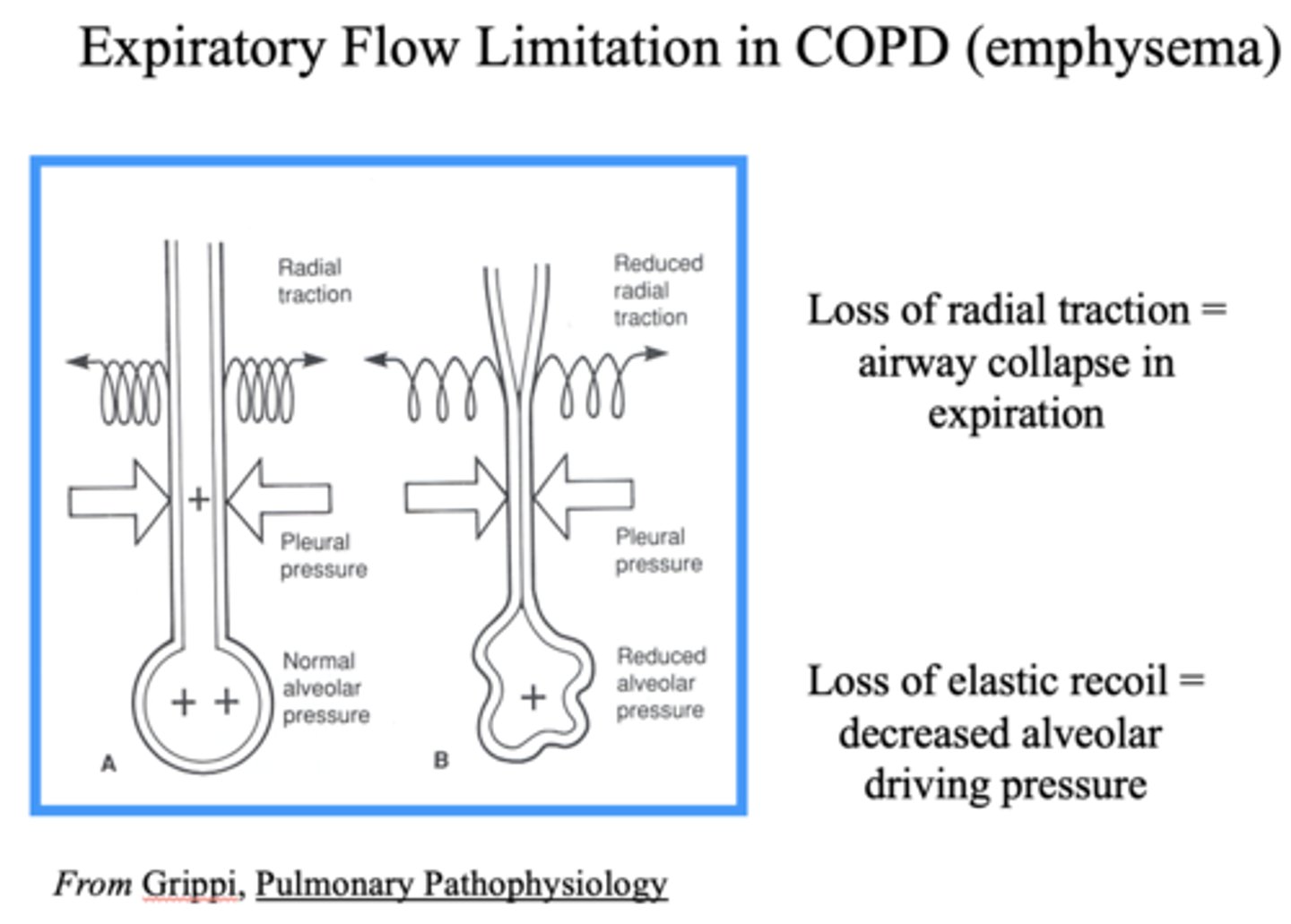 <p>Decreased alveolar driving pressure</p>