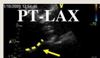 <p>what is this showing</p>