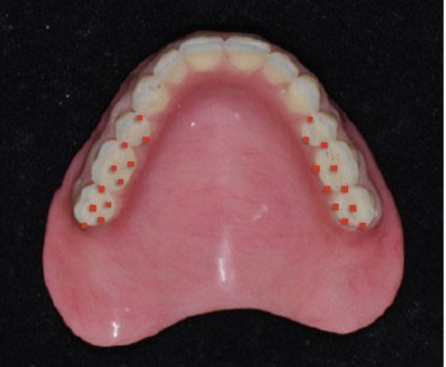 <p>Which type of BBO?</p>