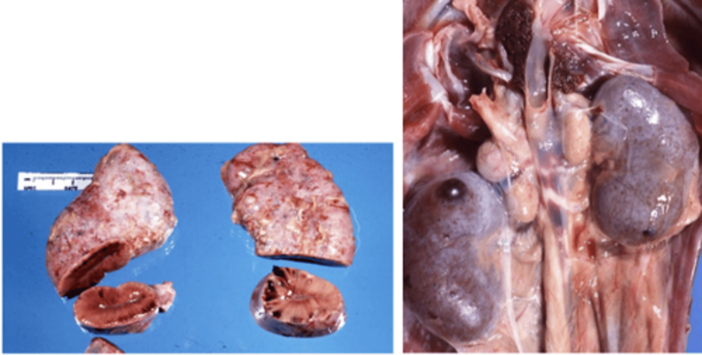 <p>What type of cellular adaptation is shown in this photo?</p>