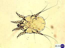 <p>Otodectes cynotis (ear mites)</p>