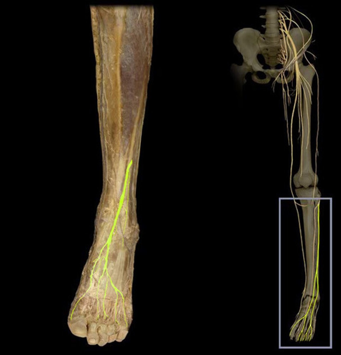 <p>-lower extremity (knee, crus, ankle)</p>