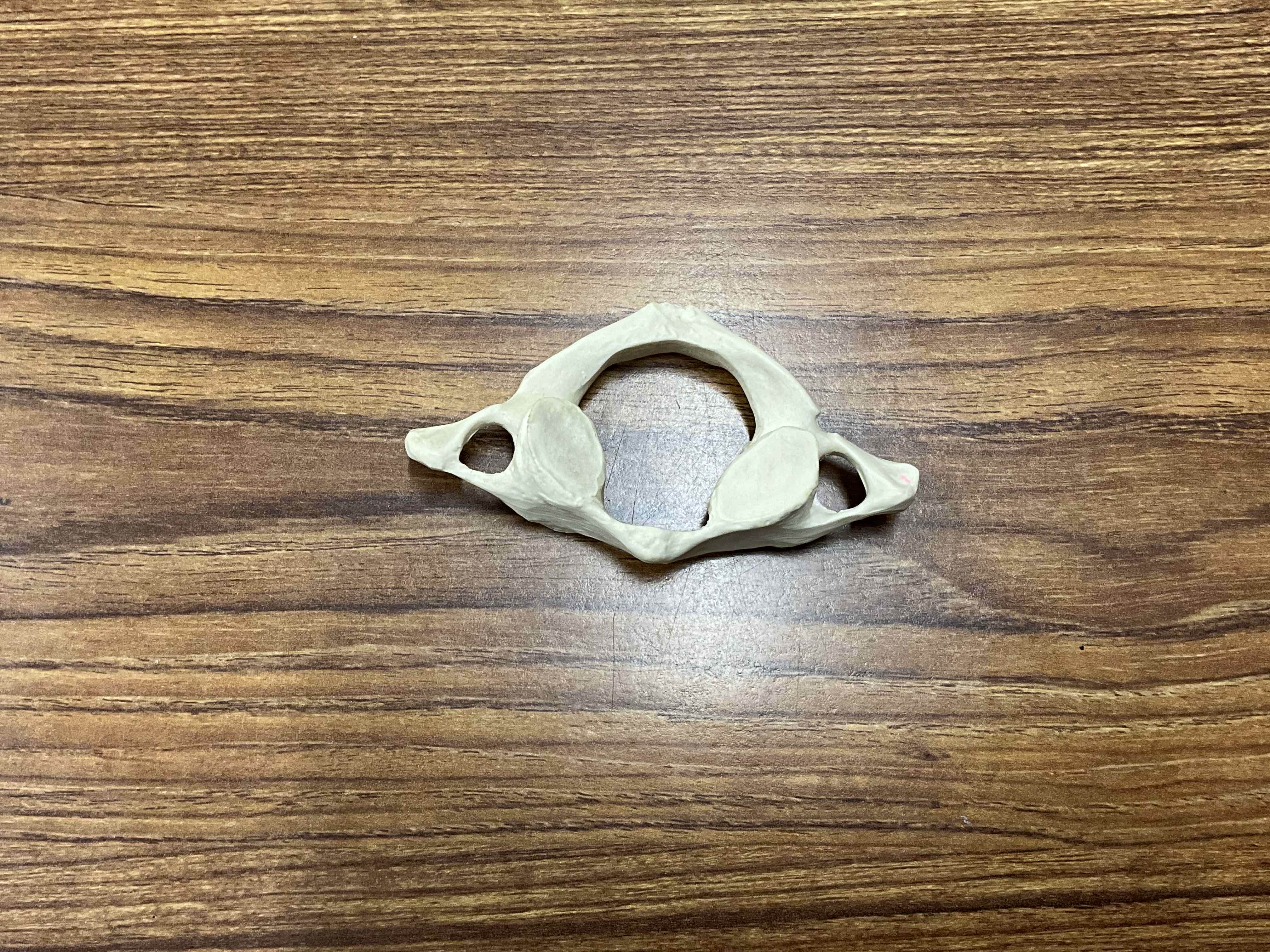 <p>Name the bone</p>