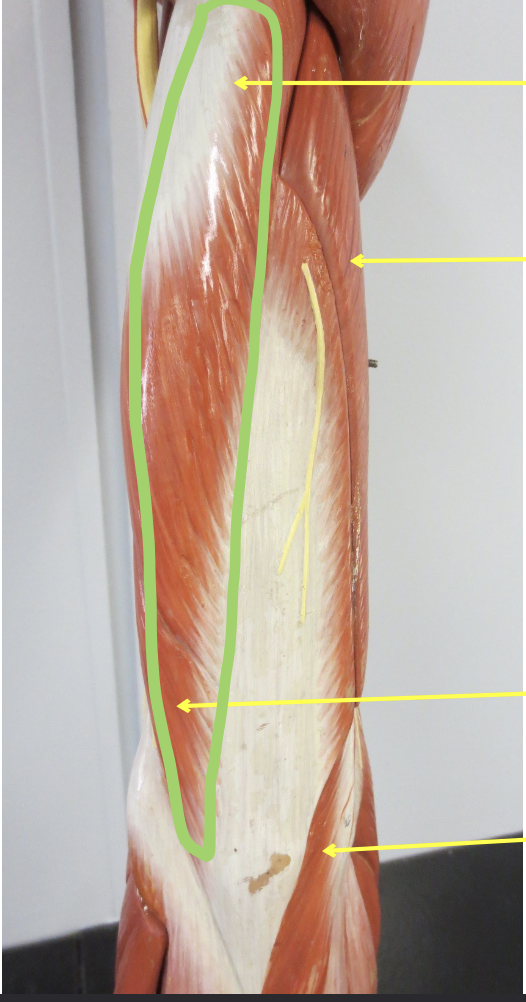 <p>Which muscle</p>