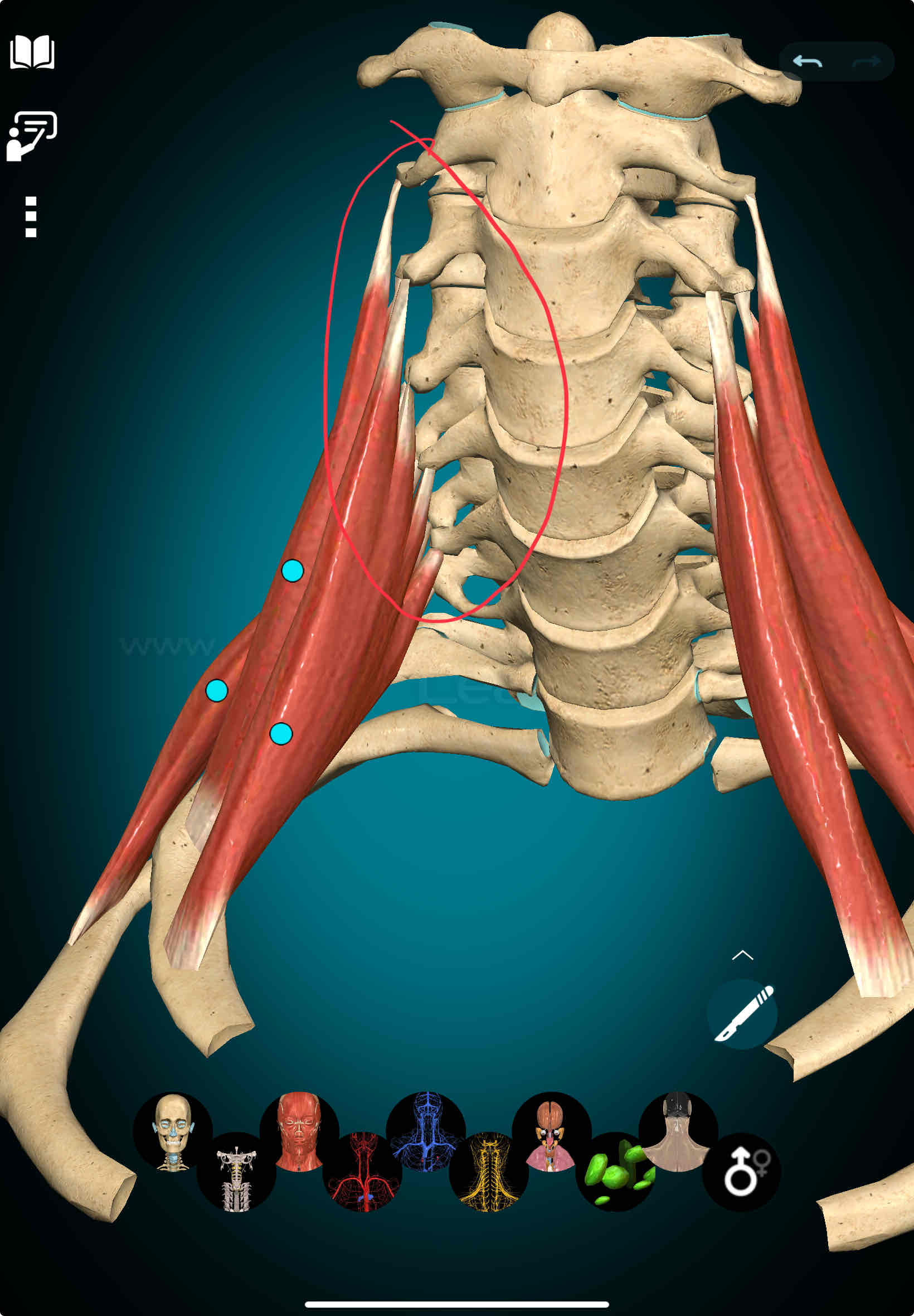 <p>Anterior Scalene Origin</p>