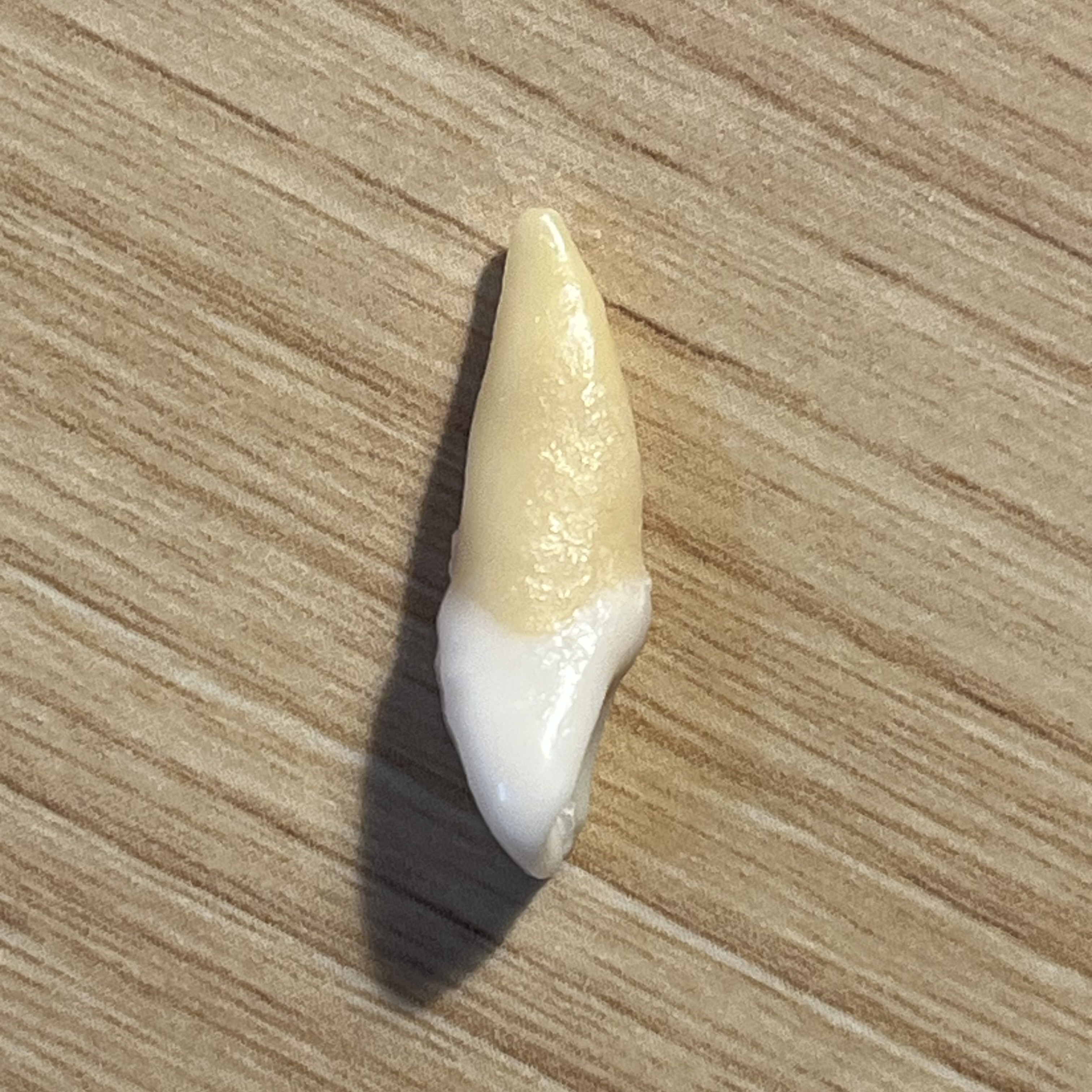 <p>What tooth is this (with view)?</p>
