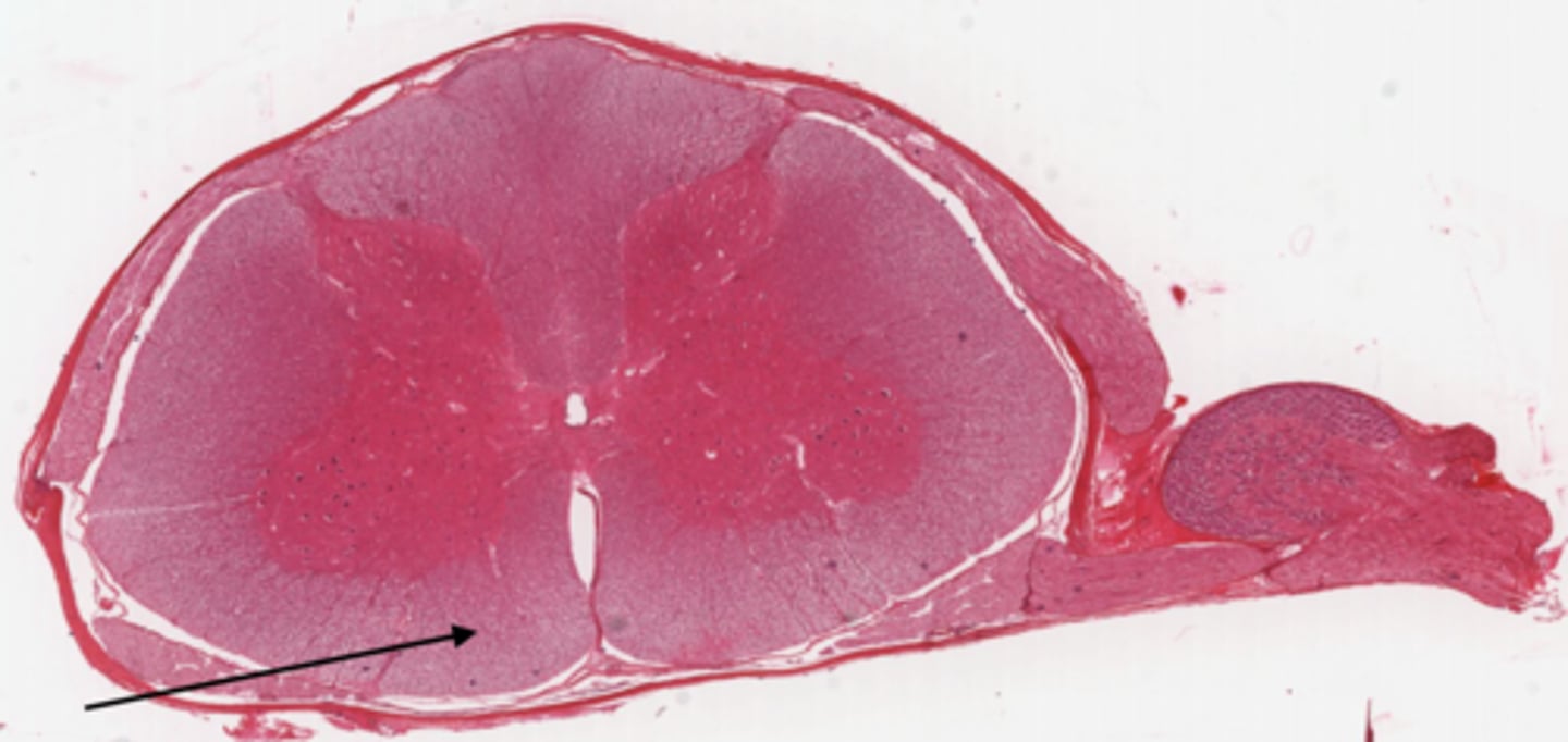 <p>Identify the part of the spinal cord</p>