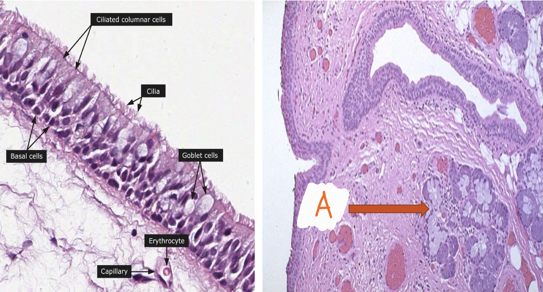 <p>Identify the structure and lining epithelium</p>