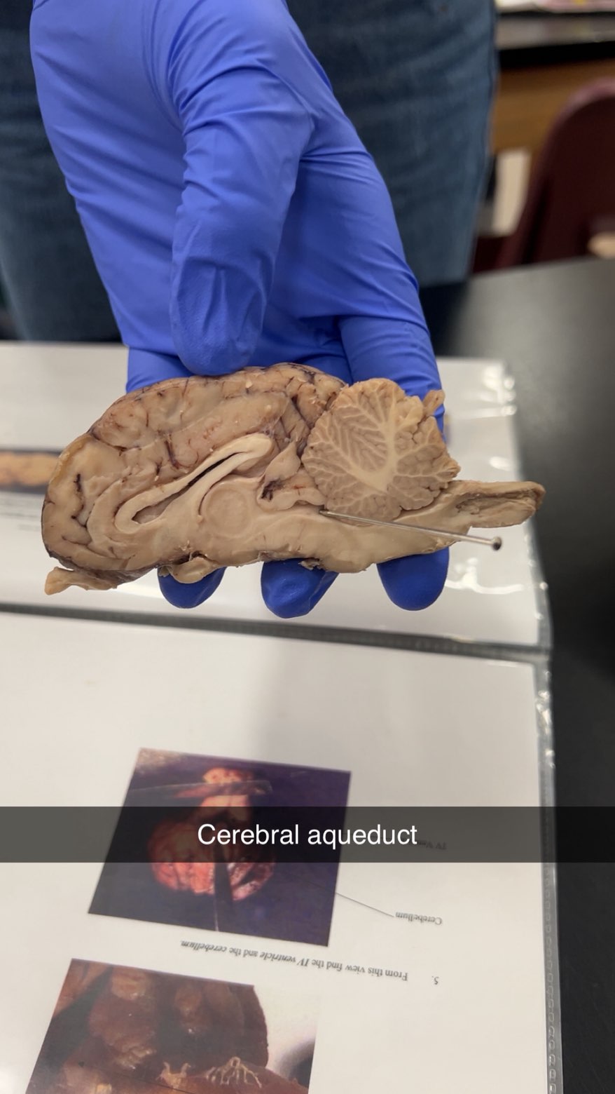 <p>cerebral aqueduct</p>