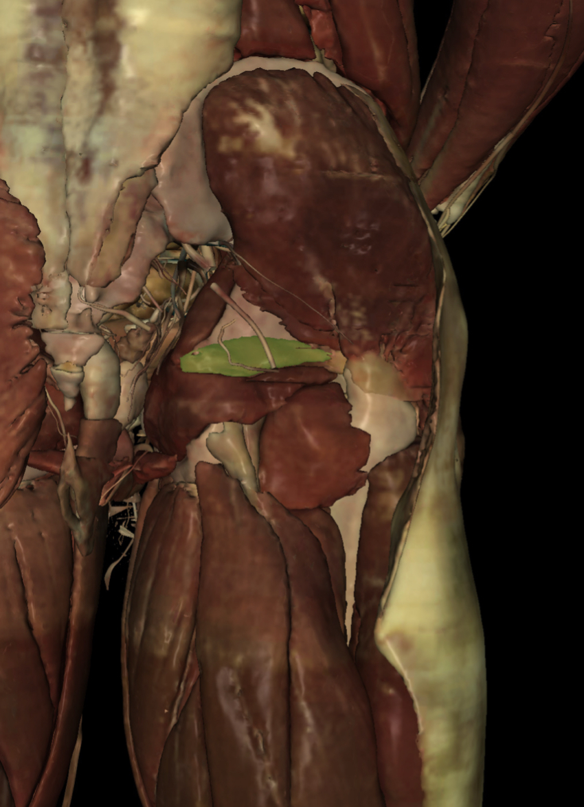 <p>Identify the Structure</p>