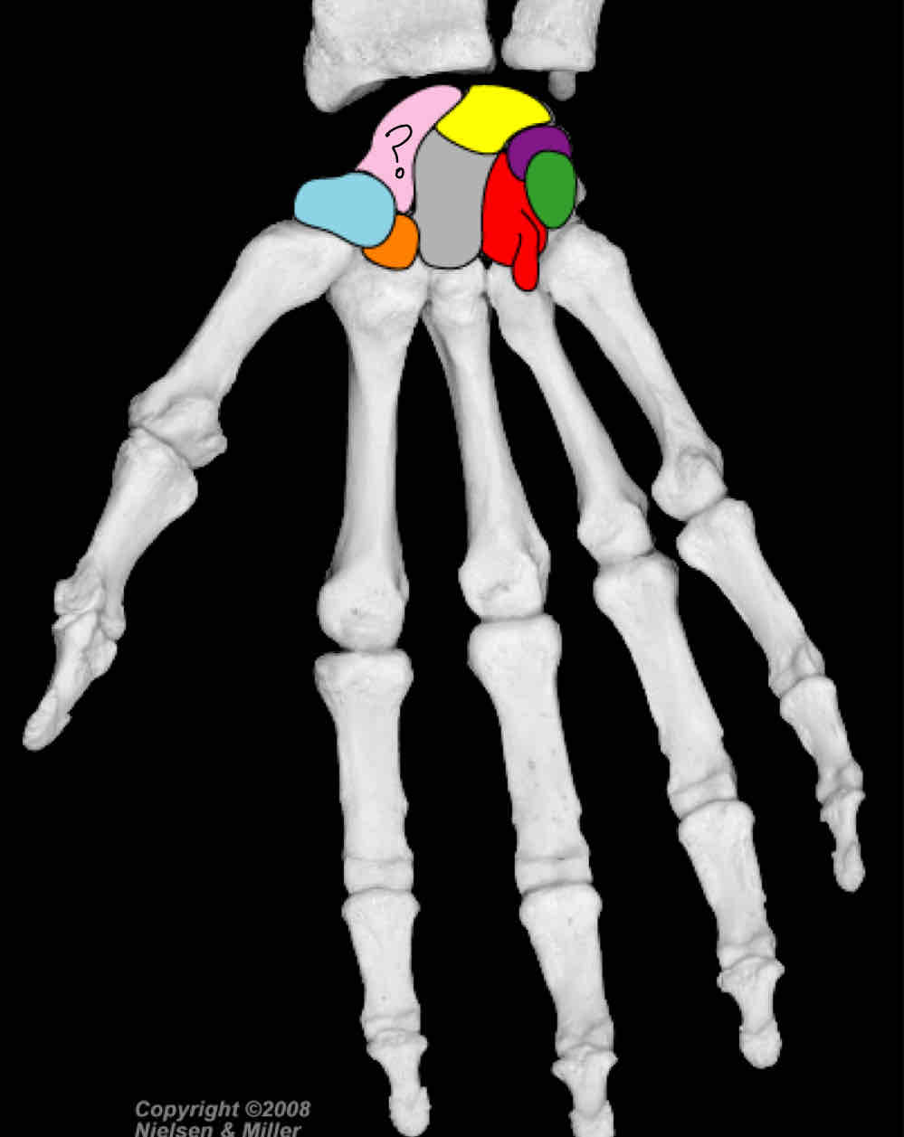 term image