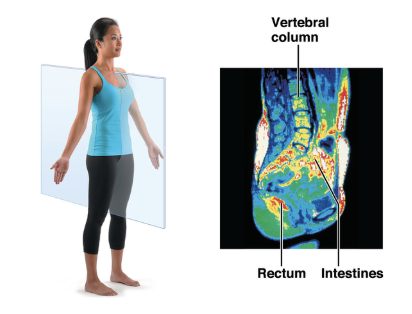 <p>A ____ MRI shows half the abdomen, pelvis, and vertebral column, the rectum, and the intestines.</p>