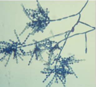 <ul><li><p><span><span>Saprophytic contaminant, but still dematiaceous</span></span></p></li><li><p><span><span>Matures in 7 days</span></span></p></li><li><p><span><span>Greenish brown to black, becomes heaped, folded with a velvety texture</span></span></p></li><li><p><span><u><span>Very similar to Cladophilophora, except conidia are NOT pointy</span></u></span></p></li></ul><p></p>