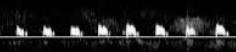 <p>what does this waveform indicate w <strong>stenosis</strong>?</p>