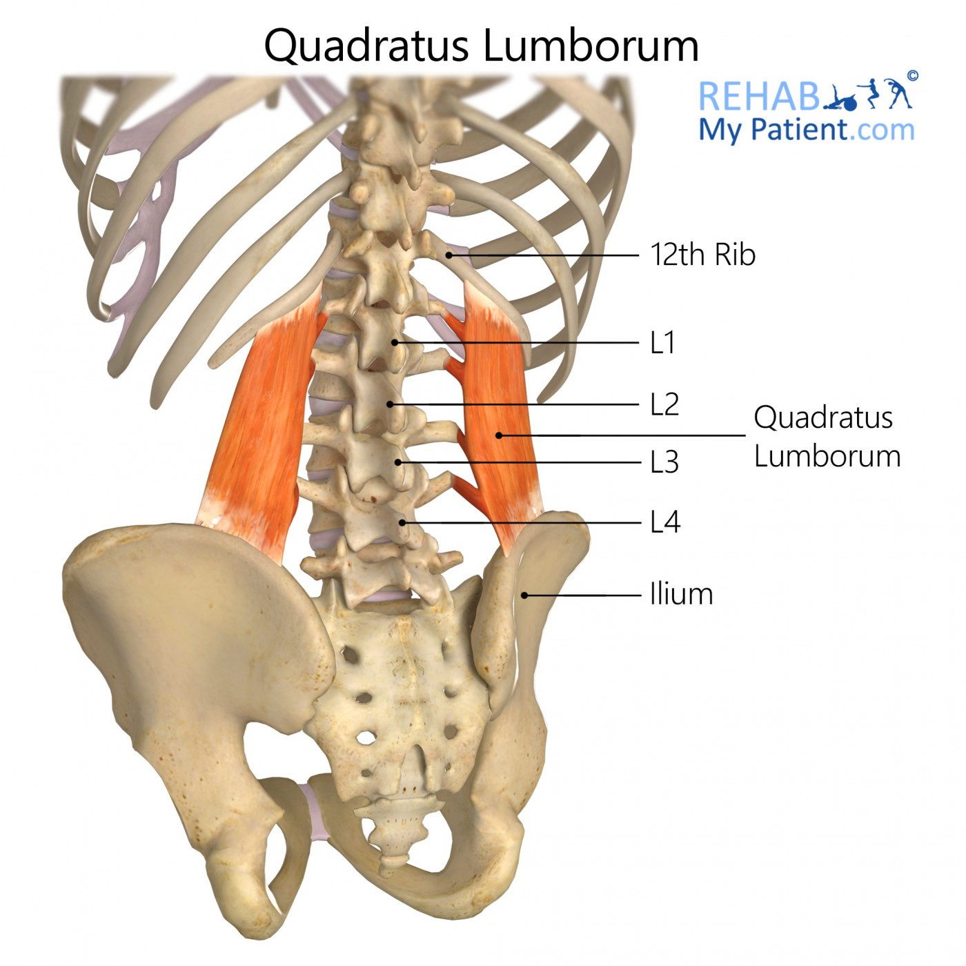 <p><strong>Proximal Attachment</strong></p><p><span>Medial half of rib 12, tips of L1-L4 transverse processes</span></p><p><strong>Distal Attachment</strong></p><p><span>Iliolumbar ligament and adjacent portion of iliac crest</span></p><p><strong>Peripheral Innervation</strong></p><p>Anterior Branches of T12 and L1-L4 nerves</p><p><strong>Action</strong></p><p><span>Fixes last rib so diaphragm acts more efficiently during inspiration; hikes hip; ipsilateral side bending when pelvis is fixed<br>Acting bilaterally forms guy wire support to stabilize lumbar spine in frontal plane</span></p>