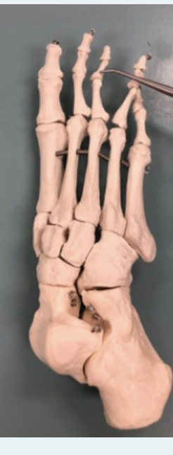 <p><span style="font-family: -apple-system, system-ui, Segoe UI, Roboto, Helvetica Neue, Arial, Noto Sans, Liberation Sans, sans-serif, Apple Color Emoji, Segoe UI Emoji, Segoe UI Symbol, Noto Color Emoji">Identify this bone.</span></p>