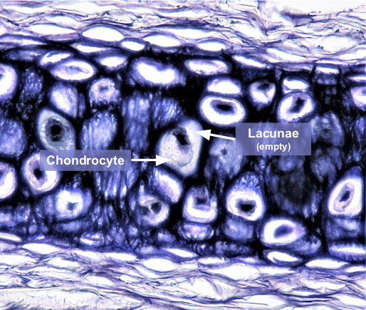 <p>has a matrix with many ELASTIC FIBERS </p><ul><li><p>withstand repetitive bending/manipulation, while maintaining original shape&nbsp;</p></li></ul><p></p>