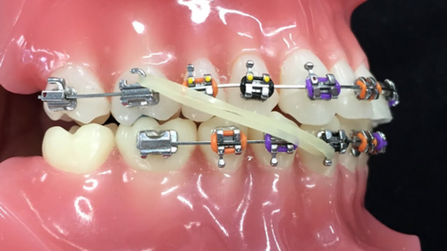 <p>first molar; canine</p>