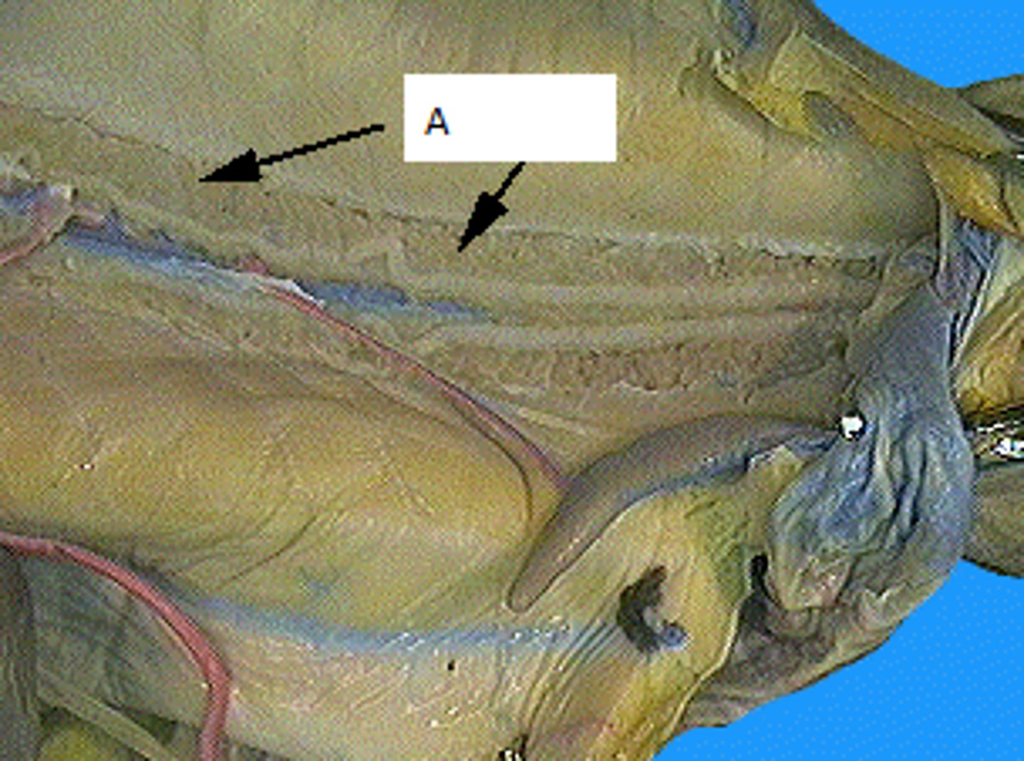 <p>Part Labeled A</p>